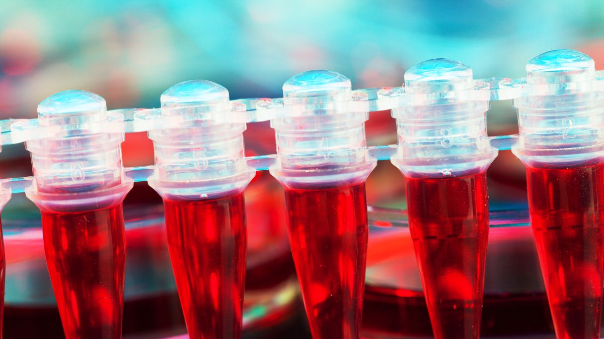 Czym jest hemofilia?