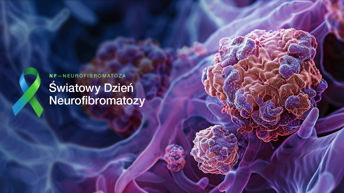 Leczenie dorosłych pacjentów z neurofibromatozą - wyzwania i możliwości terapeutyczne w Polsce