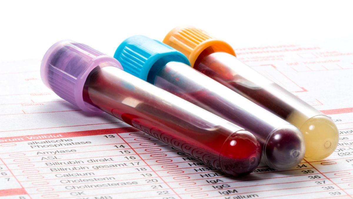 Nowy pakiet farmaceutyczny ma wyrównać szanse pacjentów w całej Unii. W Polsce na niektóre leki czeka się ponad dwa lata dłużej niż w Niemczech
